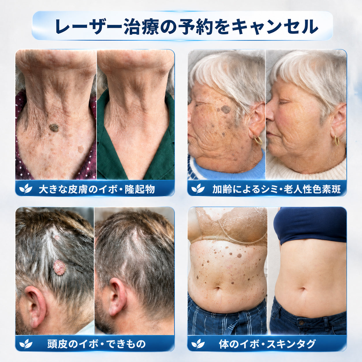 薬剤師もおすすめ💕 Hiskin® 7日間 タグ＆スポットイレーサー🪄 （痛みゼロ・傷あとゼロを目指すローラーボールタイプ）👩‍⚕️