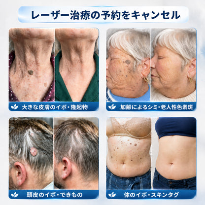 薬剤師もおすすめ💕 Hiskin® 7日間 タグ＆スポットイレーサー🪄 （痛みゼロ・傷あとゼロを目指すローラーボールタイプ）👩‍⚕️
